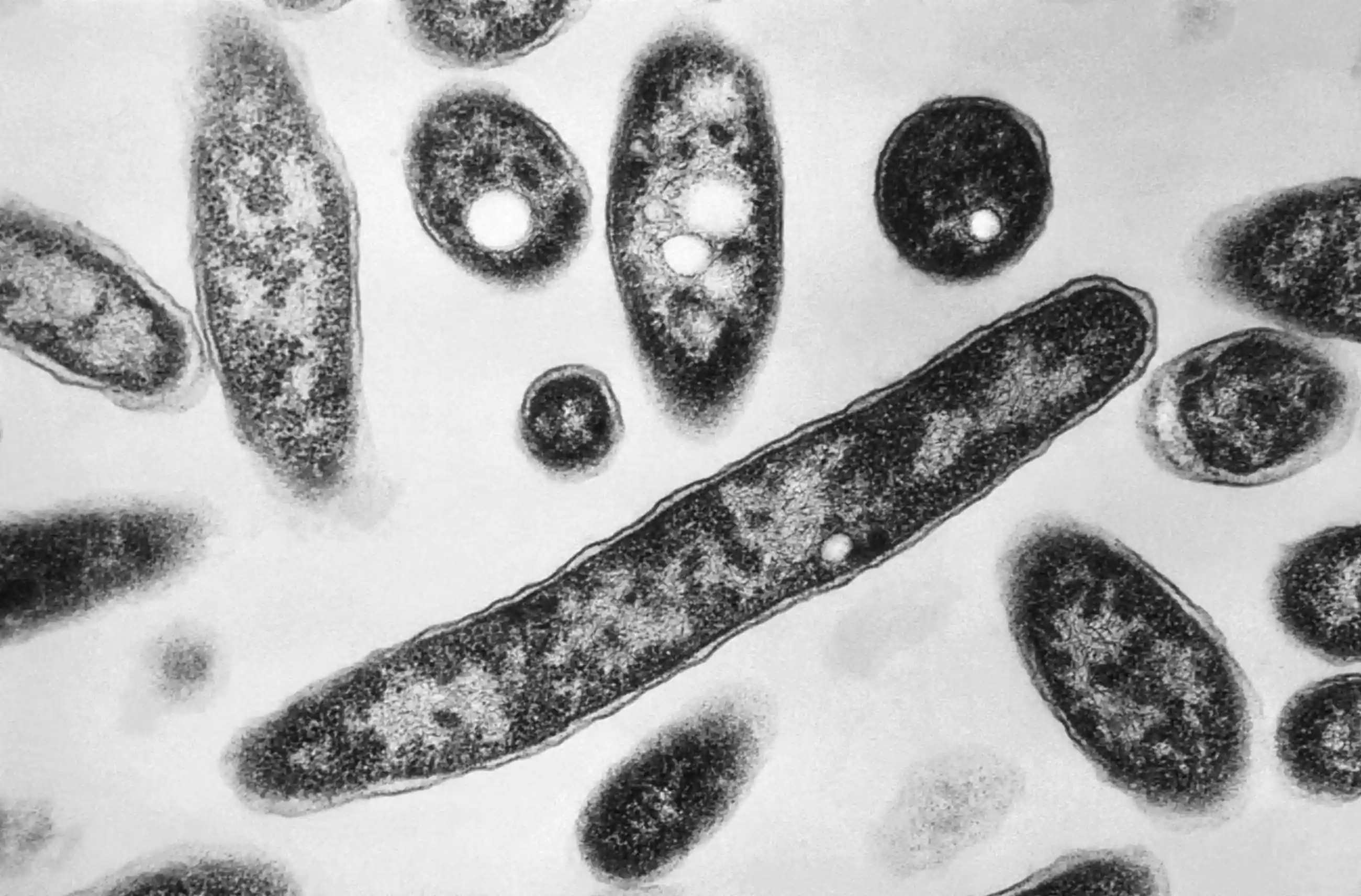 NYC Legionnaires’ Crisis Worsens as Bacteria Found in Manhattan Cooling Towers